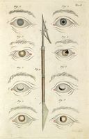 Ricerche sulle pupille artificiali con cinque tavole incise in rame e colorite.