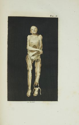  Marcolini Francesco Maria : Sulle Mummie di Venzone. Memoria [...] con tavole alluminate.  - Asta Libri & Grafica - Libreria Antiquaria Gonnelli - Casa d'Aste - Gonnelli Casa d'Aste