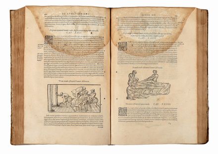  Par� Ambroise : Opera [...]. A docto viro plur�erisque locis recognita: Et latinitate donata, Iacobi Guillemeau [...] labore & diligentia.  Jacques Guillemeau  - Asta Libri & Grafica - Libreria Antiquaria Gonnelli - Casa d'Aste - Gonnelli Casa d'Aste