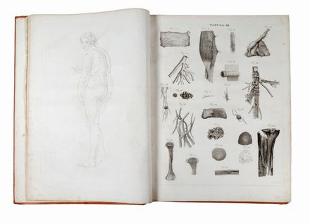  Caldani Leopoldo Marco Antonio, Caldani Floriano : Icones anatomicae quotquot sunt celebriores ex optimis neotericorum operibus summa diligentia depromptae et collectae... (-Volumins tertii sectio altera). Figurato, Medicina, Collezionismo e Bibliografia  - Auction Books & Graphics - Libreria Antiquaria Gonnelli - Casa d'Aste - Gonnelli Casa d'Aste