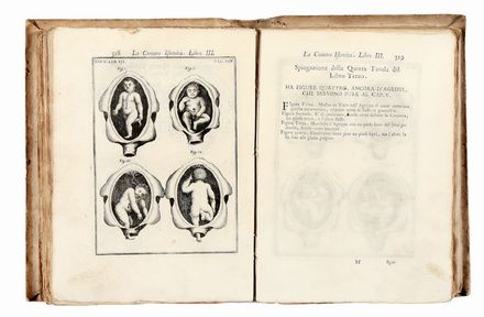  Melli Sebastiano : La Comare levatrice istruita nel suo ufizio. Secondo le Regole più certe, e gli Ammaestramenti più moderni... Medicina, Figurato, Ostetricia, Collezionismo e Bibliografia, Medicina  - Auction Books & Graphics - Libreria Antiquaria Gonnelli - Casa d'Aste - Gonnelli Casa d'Aste