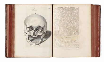  Ruysch Frederik : Opera omnia anatomico-medico-chirurgica...  - Asta Libri & Grafica - Libreria Antiquaria Gonnelli - Casa d'Aste - Gonnelli Casa d'Aste