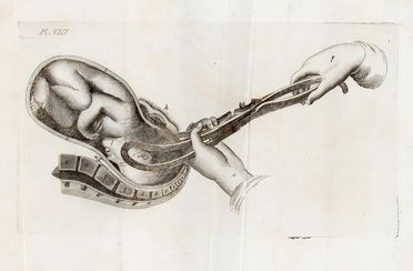  Baudelocque Jean Louis : Della ostetricia [...]. Tomo I-IV.  Gennaro Bartoli  - Asta Libri & Grafica - Libreria Antiquaria Gonnelli - Casa d'Aste - Gonnelli Casa d'Aste
