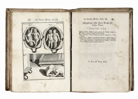  Melli Sebastiano : La Comare levatrice istruita nel suo ufizio. Secondo le Regole più certe, e gli Ammaestramenti più moderni...  Joseph Capuron  - Asta Grafica & Libri - Libreria Antiquaria Gonnelli - Casa d'Aste - Gonnelli Casa d'Aste