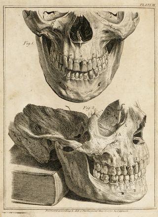  Hunter John : The natural history of the human teeth... Medicina, Odontoiatria, Medicina  - Auction Graphics & Books - Libreria Antiquaria Gonnelli - Casa d'Aste - Gonnelli Casa d'Aste