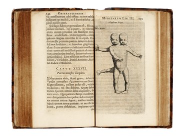  Tulp Nicolaas : Observationes medicae...  - Asta Libri, autografi e manoscritti - Libreria Antiquaria Gonnelli - Casa d'Aste - Gonnelli Casa d'Aste