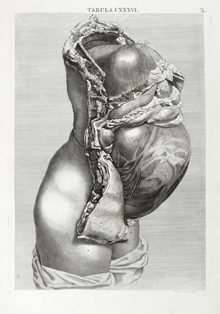  Caldani Leopoldo Marco Antonio : Icones anatomicae quotquot sunt celebriores ex optimis neotericorum operibus summa diligentia depromptae et collectae... (-Volumins tertii sectio altera).  Floriano Caldani  (Bologna, 1772 - Padova, 1836)  - Asta Libri, autografi e manoscritti - Libreria Antiquaria Gonnelli - Casa d'Aste - Gonnelli Casa d'Aste