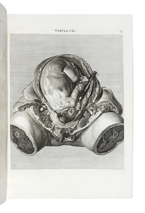  Caldani Leopoldo Marco Antonio : Icones anatomicae quotquot sunt celebriores ex optimis neotericorum operibus summa diligentia depromptae et collectae... (-Volumins tertii sectio altera).  Floriano Caldani  (Bologna, 1772 - Padova, 1836)  - Asta Libri, autografi e manoscritti - Libreria Antiquaria Gonnelli - Casa d'Aste - Gonnelli Casa d'Aste