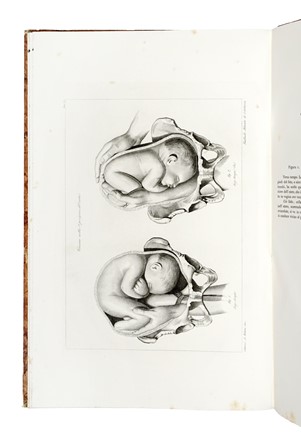 Raffaele Giovanni : Ostetricia teorico pratica [...] Atlante di figure tratte dai pi� pregiati autori e migliorate secondo i progressi della scienza. Parti naturali (-artificiali) Ostetricia, Medicina, Figurato, Atlanti, Medicina, Collezionismo e Bibliografia, Geografia e viaggi  - Auction Books, Autographs and Manuscripts - Libreria Antiquaria Gonnelli - Casa d'Aste - Gonnelli Casa d'Aste