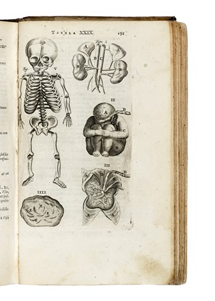  Bartholin Thomas : Anatomia, ex Caspari Bartolini Parentis Institutionibus... Tertium ad sanguinis Circulationem Reformata... Anatomia, Medicina, Chirurgia, Medicina, Medicina  - Auction Books, Autographs and Manuscripts - Libreria Antiquaria Gonnelli - Casa d'Aste - Gonnelli Casa d'Aste