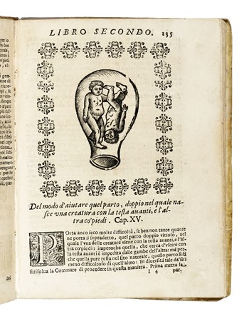  Mercurio Girolamo : La Commare o Raccoglitrice [...] In questa ultima edizione corretta & accresciuta di due trattati; uno del Colostro, dove si tratta di diversi mali de i bambini [...] L'altro di un gravissimo Autore, nel quale si risolvono alcuni dubbi circa il Battesimo. Medicina, Ostetricia, Medicina  - Auction Books, Autographs and Manuscripts - Libreria Antiquaria Gonnelli - Casa d'Aste - Gonnelli Casa d'Aste