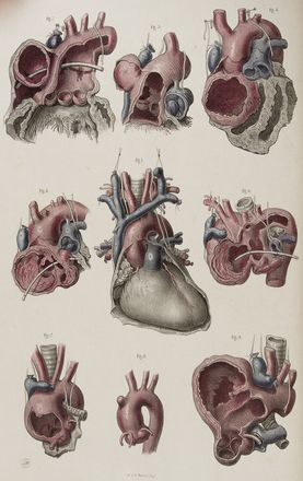  Maclise Joseph : Surgical anatomy.  - Asta Libri, Manoscritti e Autografi - Libreria Antiquaria Gonnelli - Casa d'Aste - Gonnelli Casa d'Aste