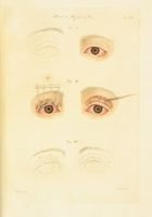 Annotazioni pratiche sulle malattie degli occhi... Libro Primo (-Terzo).