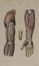  Hirschfeld Ludwig Moritz : N�vrologie ou description et iconographie du syst�me nerveux et des organes des sens... Medicina  - Auction BOOKS, MANUSCRIPTS AND AUTOGRAPHS - Libreria Antiquaria Gonnelli - Casa d'Aste - Gonnelli Casa d'Aste